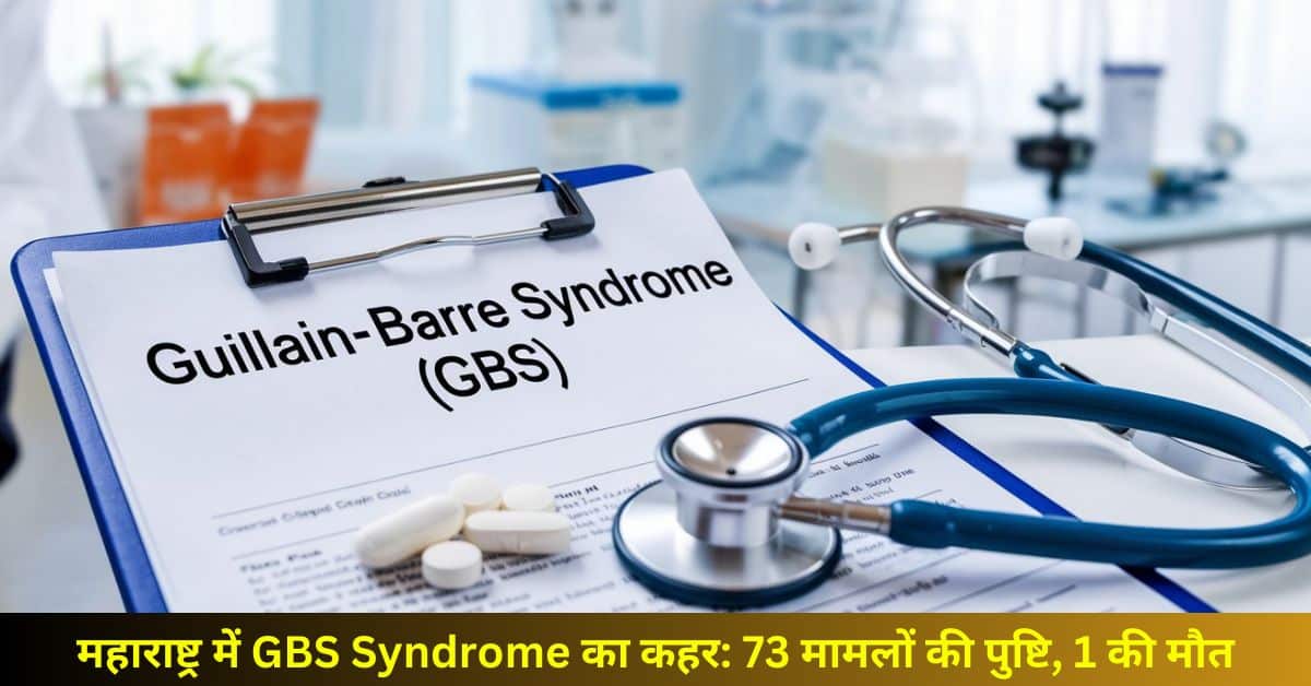 GBS Syndrome